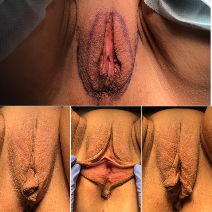 Лицо девушки и её вагина