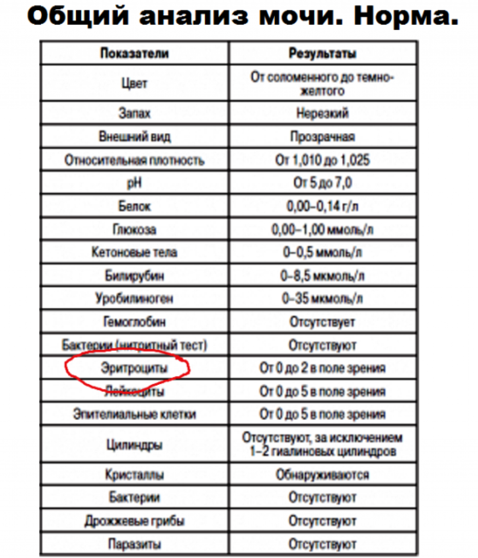 Общий анализ мочи норма