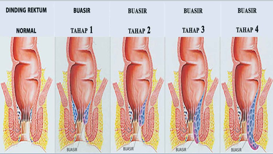 Тату на анусе домашнее