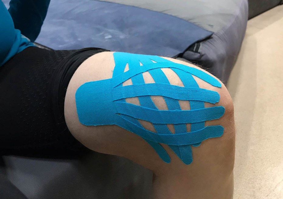 Поднадкостничная гематома