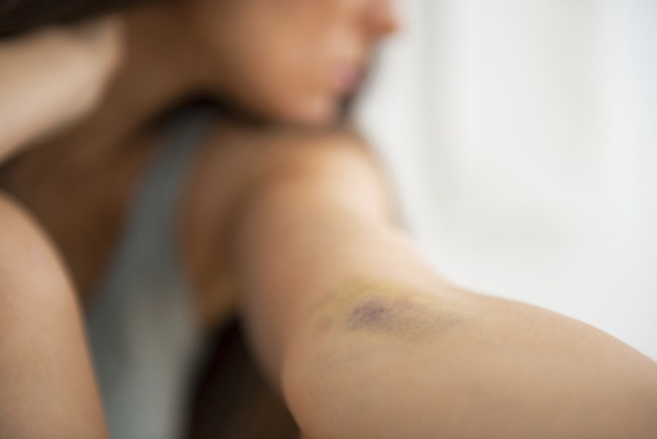 Порноактриса Милли Морис anal