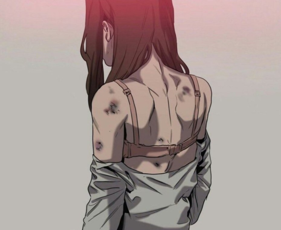 Стадии заживления синяков