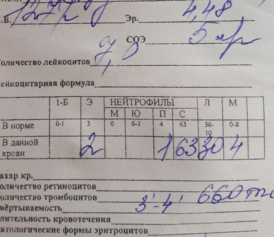 Разбитые костяшки Эстетика