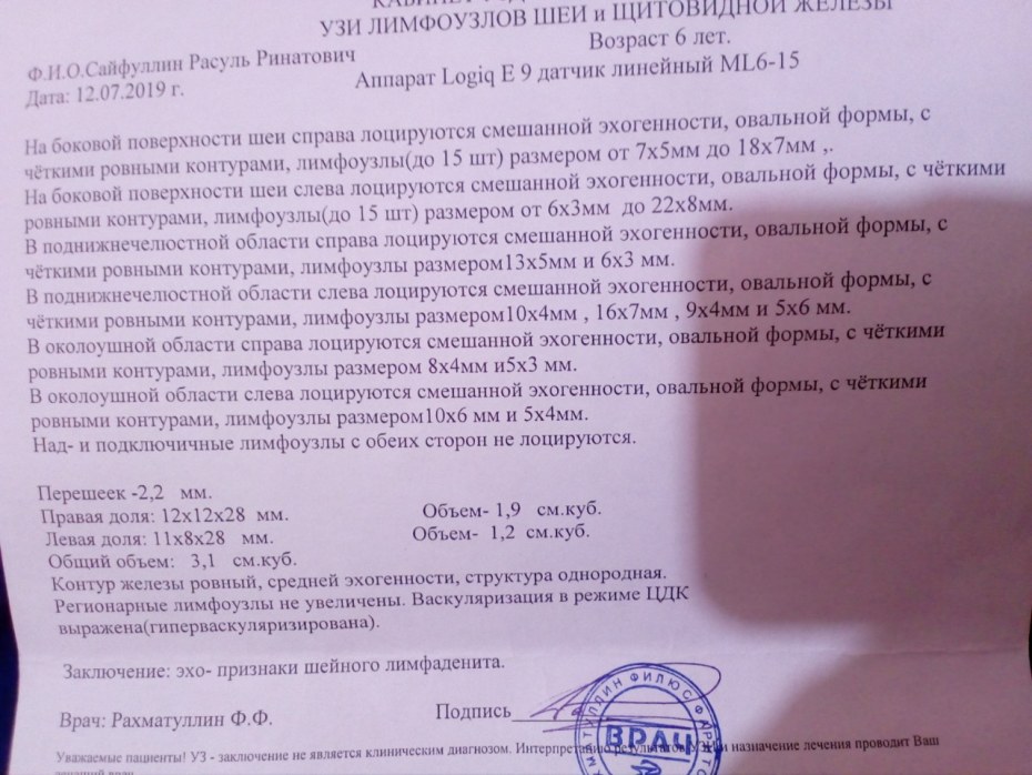 Схема нападения России на Украину