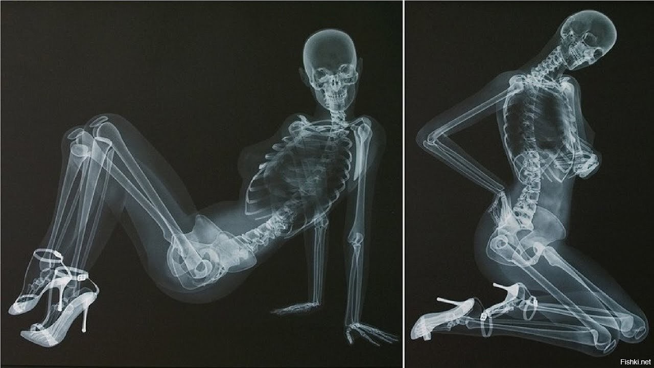 Креативный рентген-календарь с «голыми» моделями (ФОТО) | Порно на Приколе!