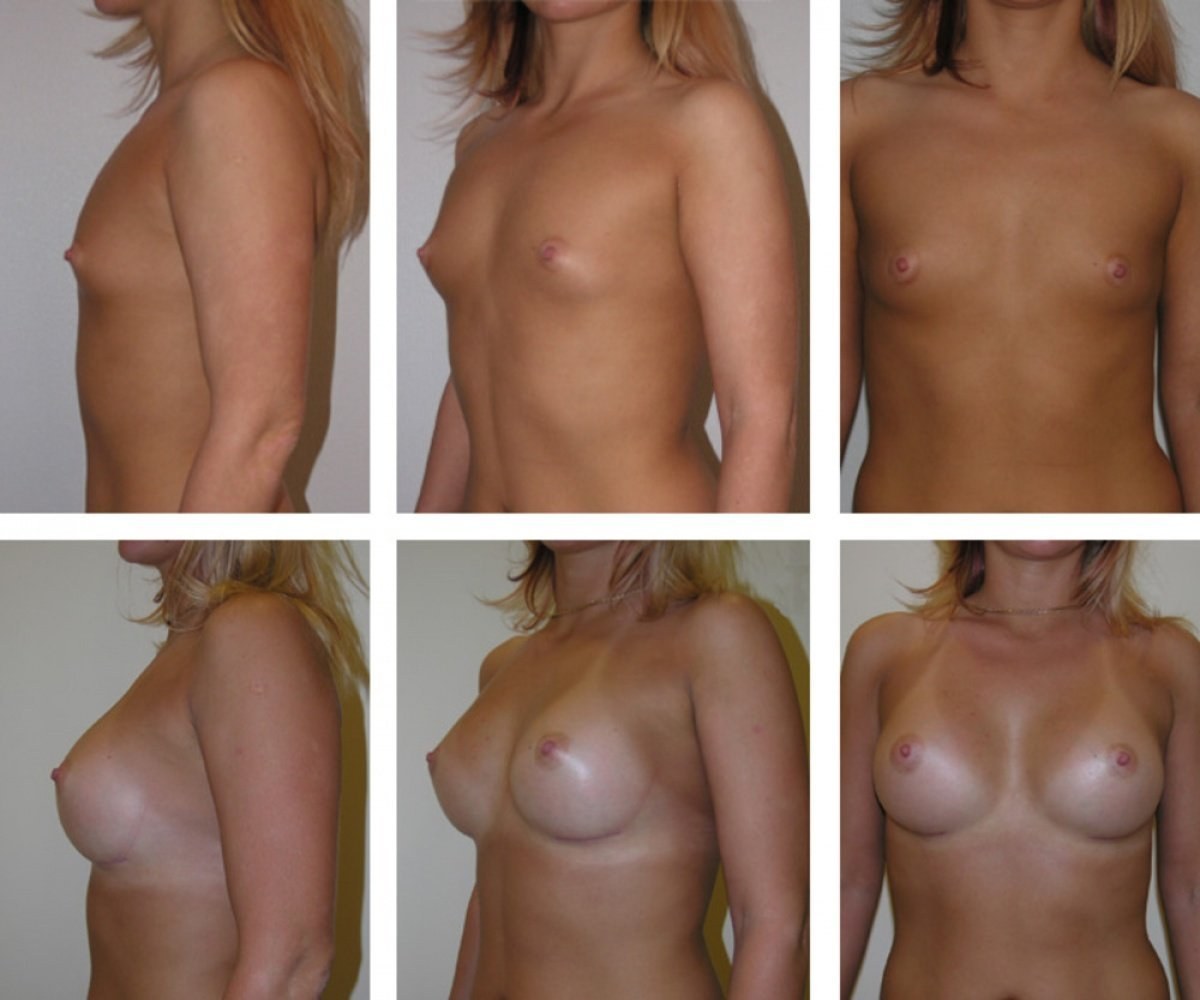 секс виды груди у женщин фото 48