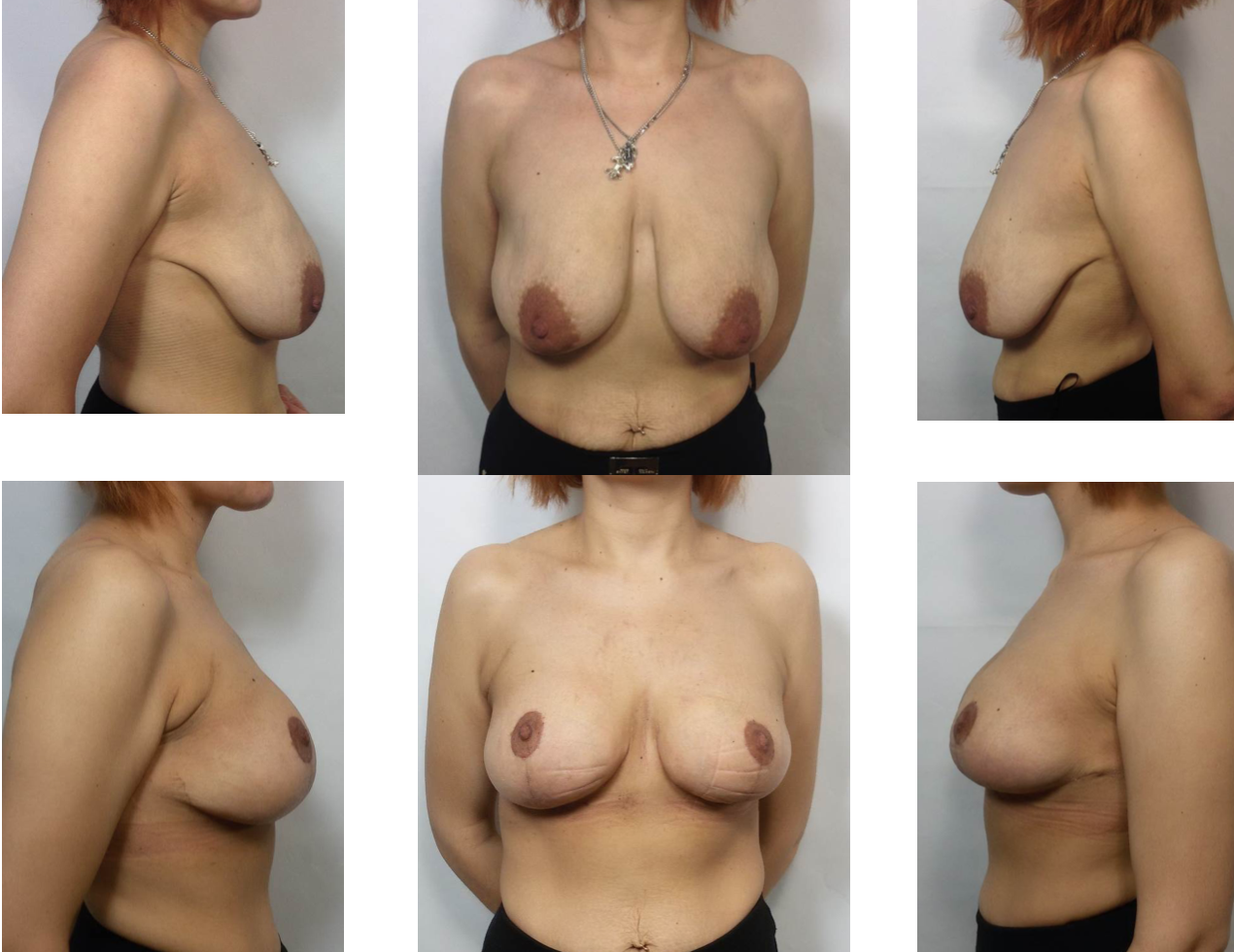 формы женской обнаженной груди фото 94