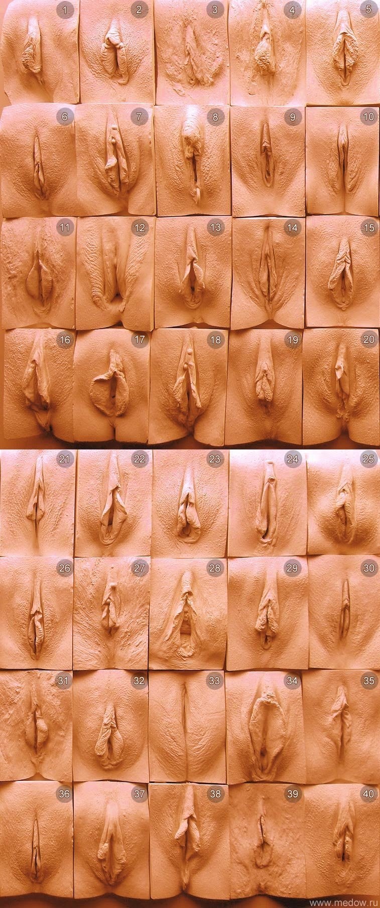 голая вагина все виды фото фото 14