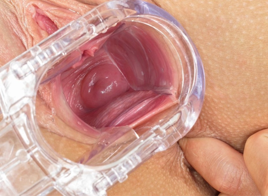 Влагалище здоровой женщины