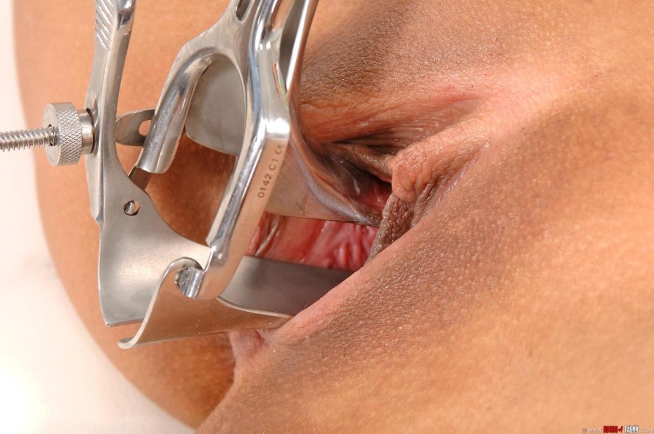 Гинекологический расширитель в вагине