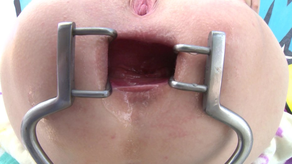 Гинекологический расширитель в вагине