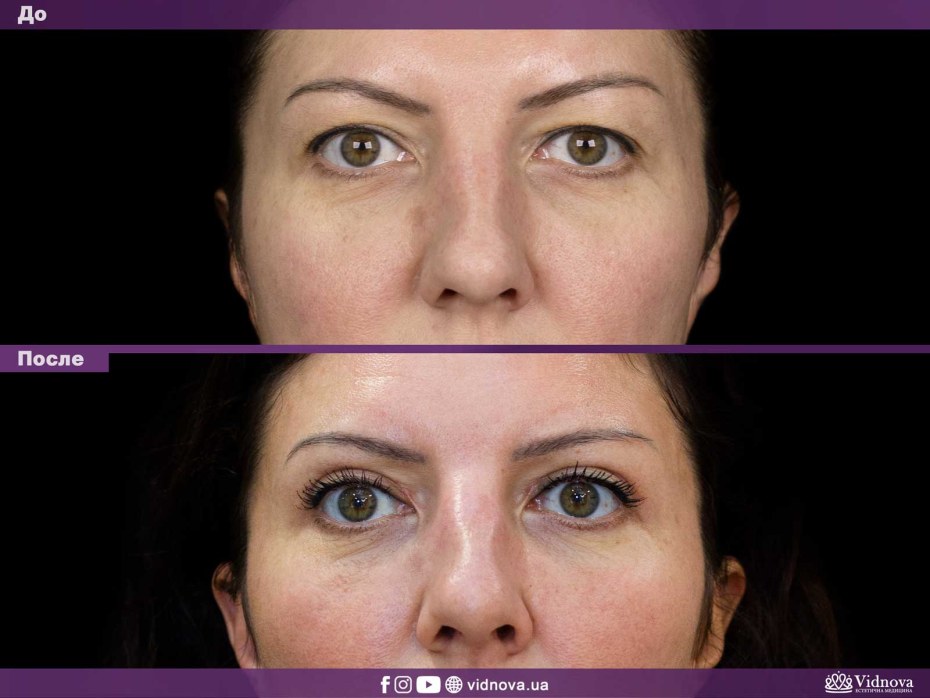 Обращаться в МФЦ