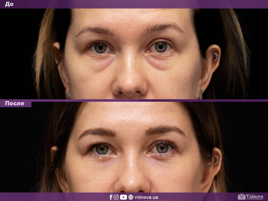 Первый раз истории из жизни