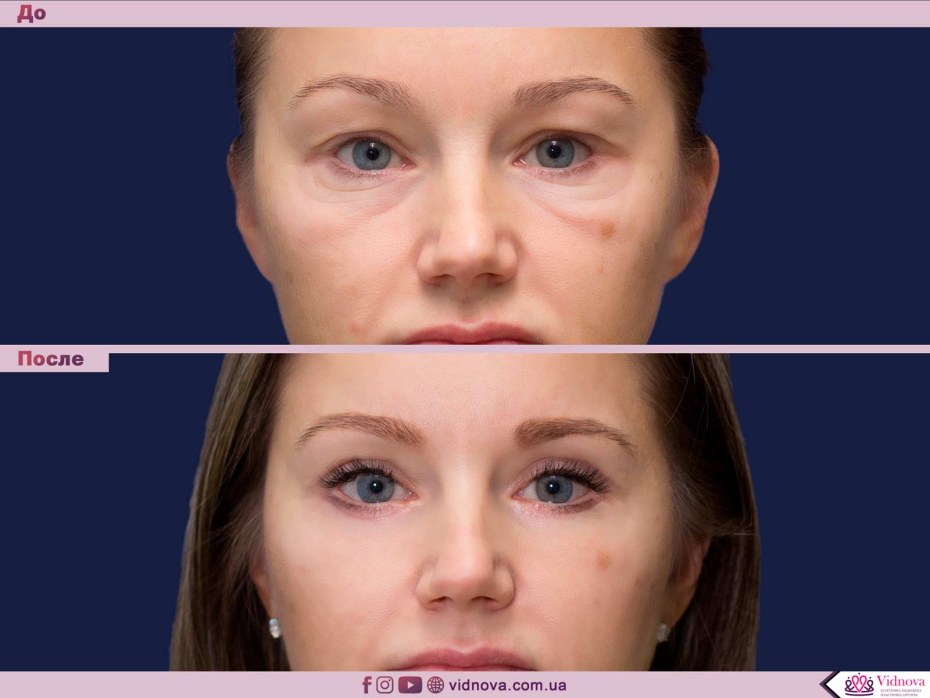 Ава для ВК удаленной страницы