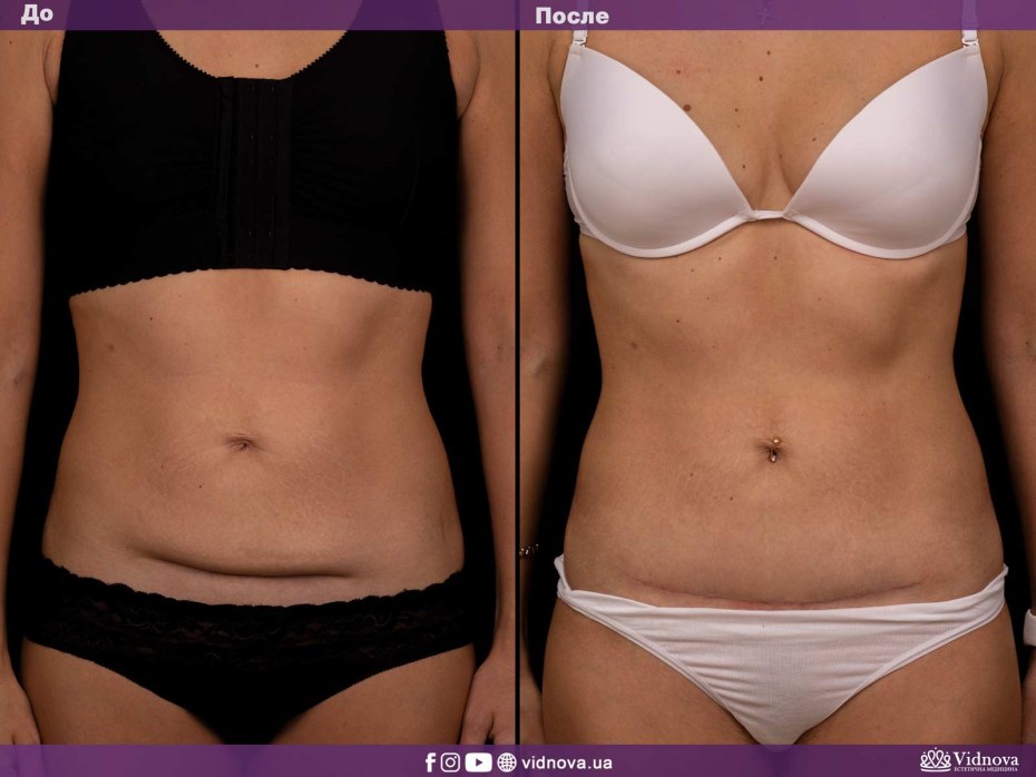 Красивое эротическое шоу