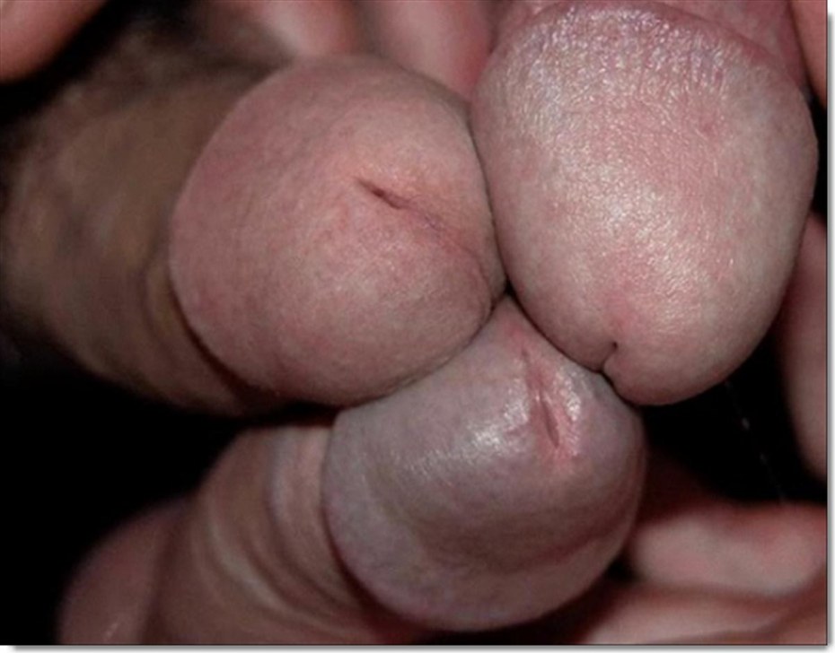 Головка члена крупным планом