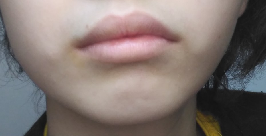 1 Моляр нижней челюсти анатомия