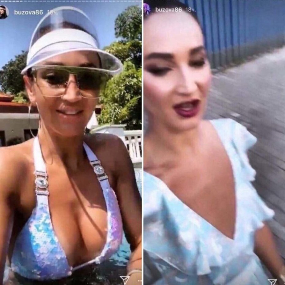 Маммопластика Ольги Бузовой