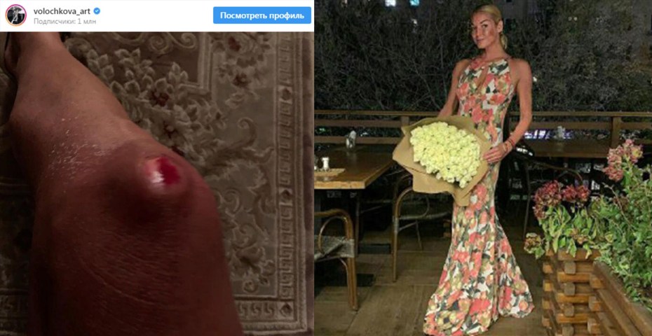 Интимные снимки Волочковой