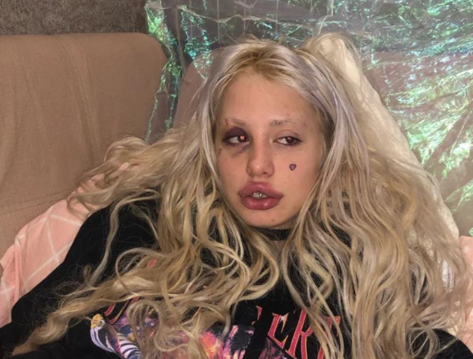 Анна Михеева хофманита